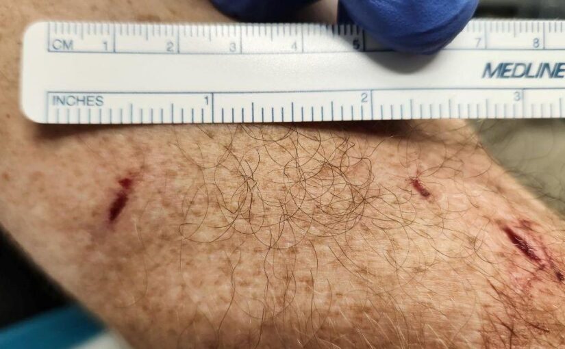 Man bitten by bear in southwest Colorado, officials searching for bear